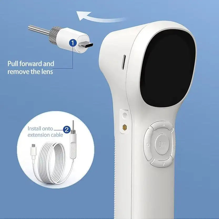 Digital Otoscope with IPS Screen, 720p HD Smart Visual, Ear Scope