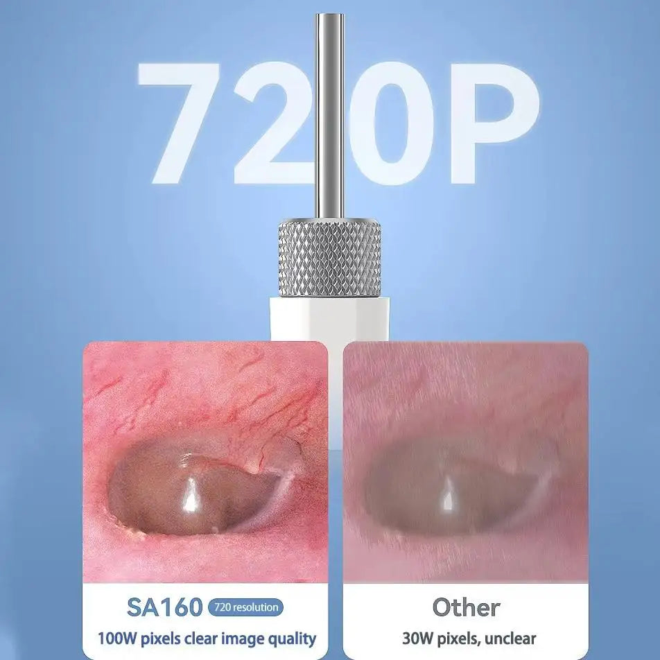Digital Otoscope with IPS Screen, 720p HD Smart Visual, Ear Scope